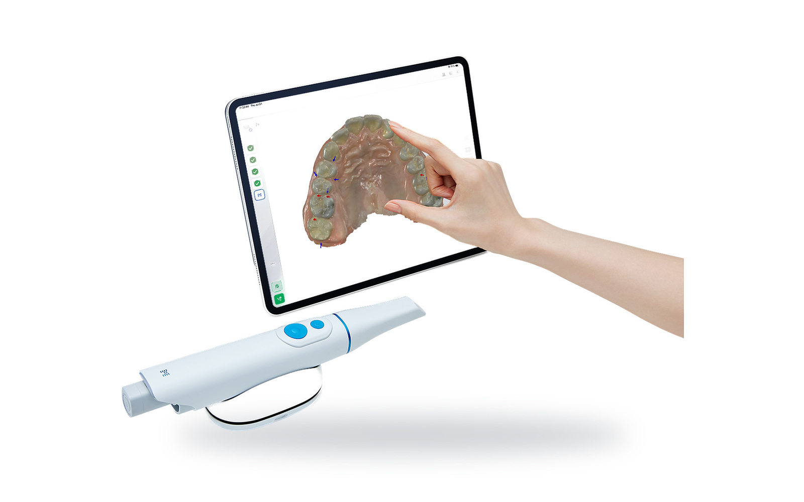 Medit intraoral scanner beside a tablet showing a scanned arch